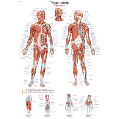 Erler Zimmer Anatomische Lehrtafel, Die Triggerpunkte